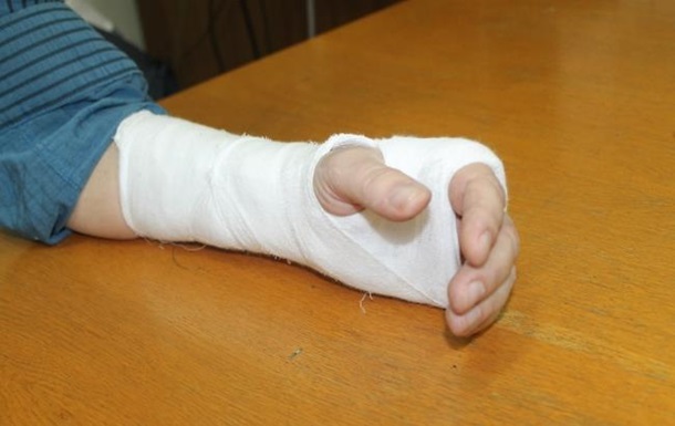 На Херсонщине помощник нардепа сломал руку редактору - СМИ
