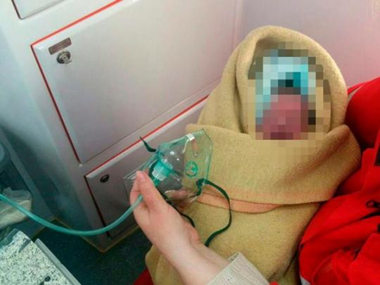 В Запорожье горожанка обнаружила на улице новорожденную малышку