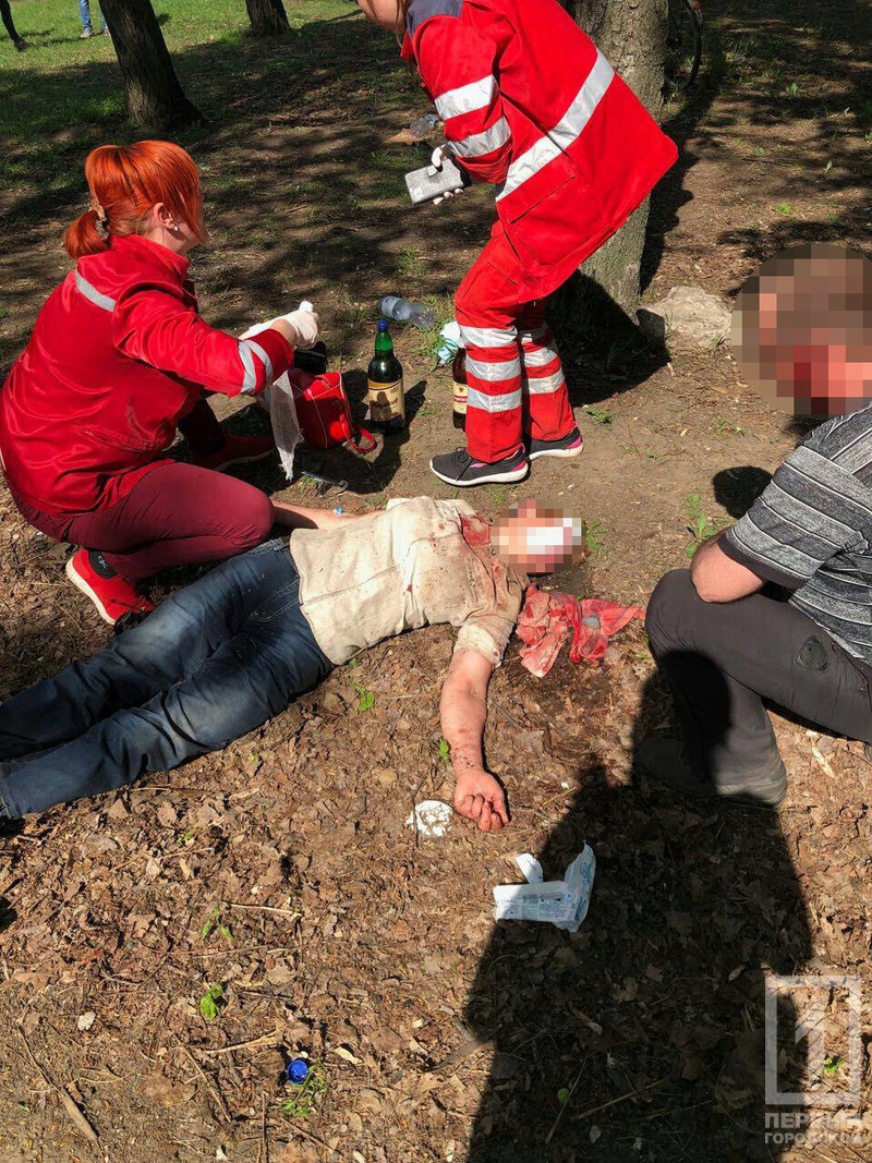 На Пасху в Кривом Роге неадекватная молодежь жестоко избила людей в городском парке (фото)