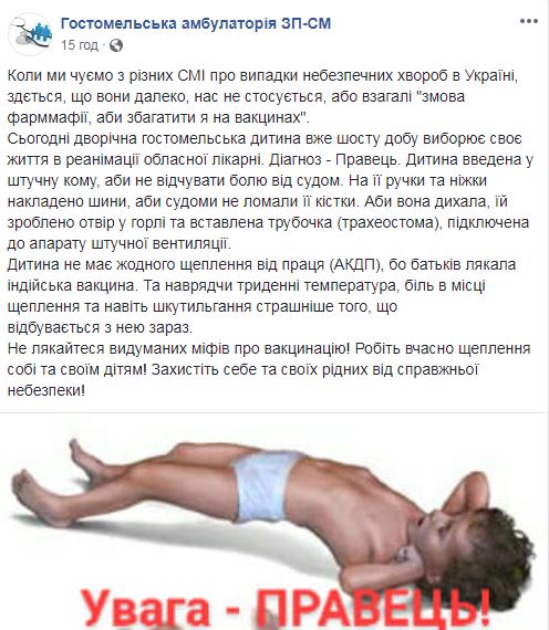 Родители испугались индийской вакцины: под Киевом врачи спасают заболевшего столбняком двухлетнего ребенка
