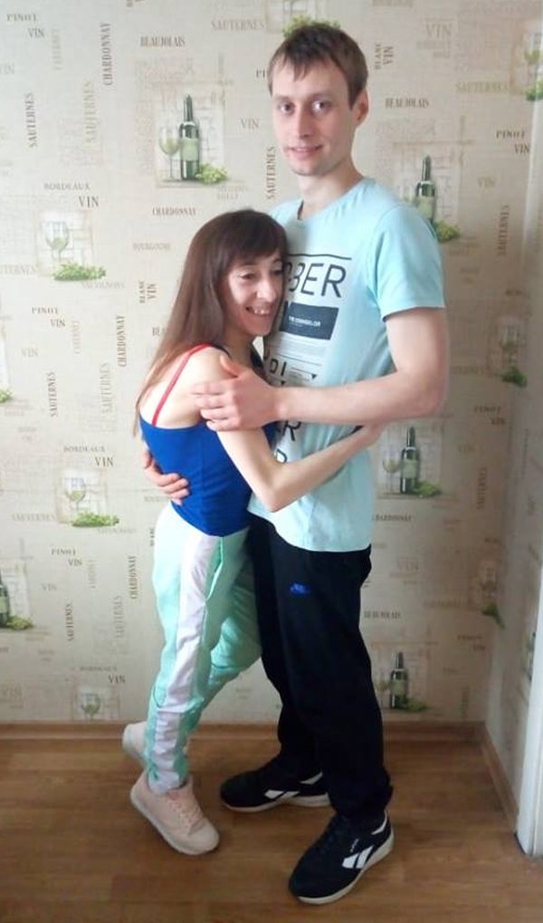Стала выше на 9 сантиметров: благодаря читателям «ФАКТОВ» девушке ростом 137 см сделали долгожданную операцию (фото) Стала выше на 9 сантиметров: благодаря читателям «ФАКТОВ» девушке ростом 137 см сделали долгожданную операцию (фото)