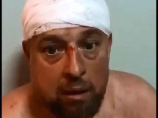 В Харькове зверски избили активиста Нацкорпуса: первые детали происшествия