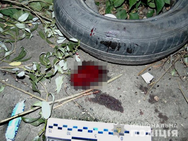 В Киеве мужчина ударил девушку ножом в шею: детали происшествия
