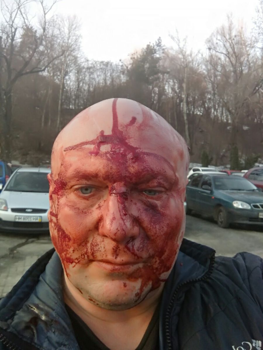 В Киеве жестоко расправились с самым известным догхантером Украины: подробности и фото