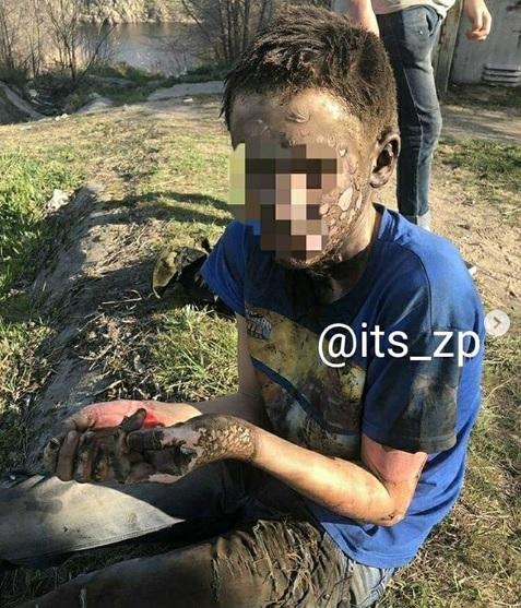 Забравшийся в электрощитовую подросток чудом выжил, но обесточил пол-Запорожья (фото)