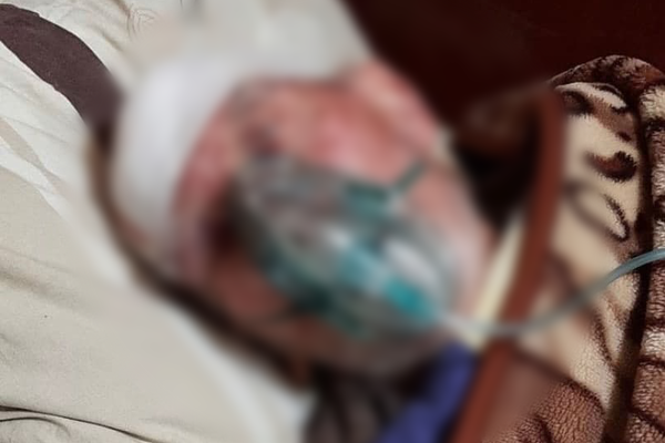 Отправили умирать с разбитой головой: в одесской больнице залечили пенсионера с Covid-19