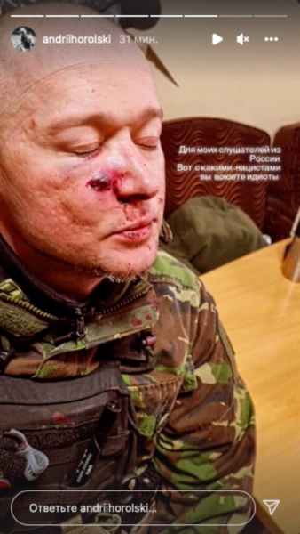Лидер «Бумбокса» Андрей Хлывнюк получил осколочное ранение