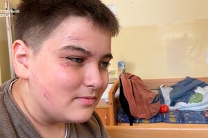 Двое братьев из Сергеевки, которые пострадали от ракет и остались сиротами, лечатся в Австрии