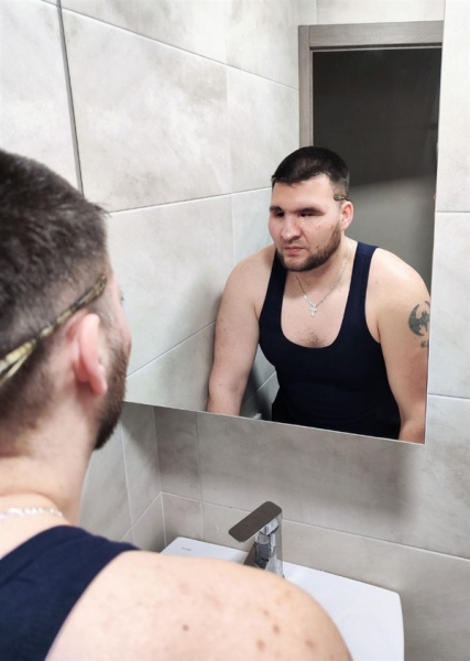 «Мрію не тільки відчути, але й побачити, як ростуть мої діти»: історія військового з Київщини, який втратив на війні зір
