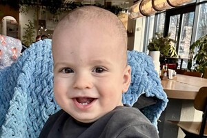 Малышу из Одесской области сделали уникальную операцию на язык: он был в пять раз длиннее