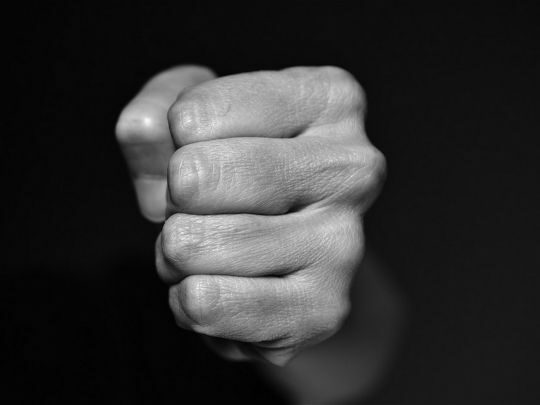 Били молотком та&nbsp;кастетом: у&nbsp;Кам'янському невідомі напали на&nbsp;волонтера, який збирав гроші для ЗСУ (відео 18+)