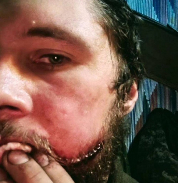 «Дорога в Авдіївку всіяна нашими трупами… Нас готові залишити помирати.»: боєць ЗСУ про те, що зараз відбувається в Авдіївці