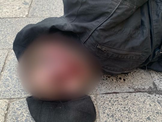 У Львові студент допоміг зловити неадеквата, який напав на молодих жінок із бритвою