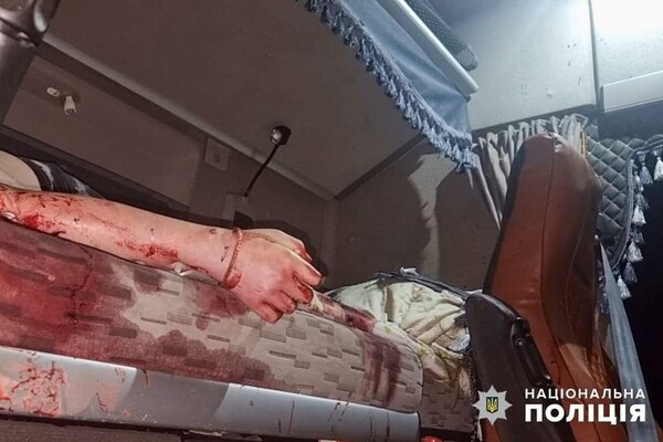 Враг атаковал Одесский район баллистикой: есть раненые и погибшие, среди жертв – десятилетняя девочка (обновлено)