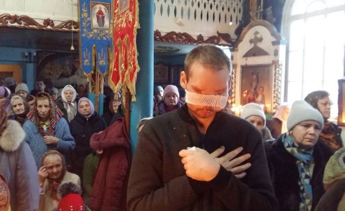«Майже всі лікарі відмовились від нього»: після важкого поранення голови та обличчя українець хоче присвятити себе допомозі іншим