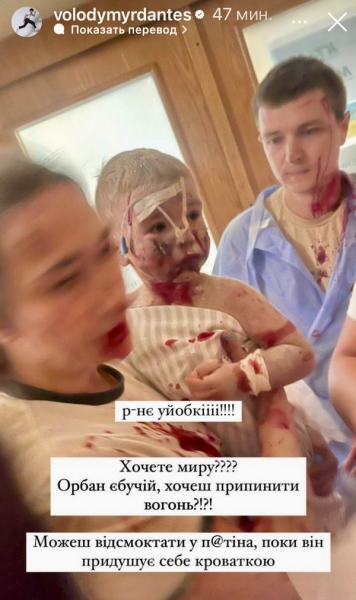 «Цим потворам байдуже»: українські зірки відреагували на чергову жахливу ракетну атаку