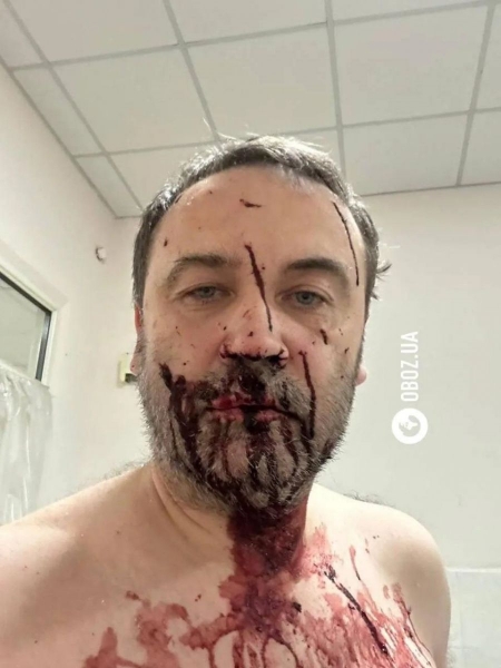 «Сьогодні у мене, схоже, другий день народження»: російський дрон вразив будинок Іллі Пономарьова під Києвом (фото)