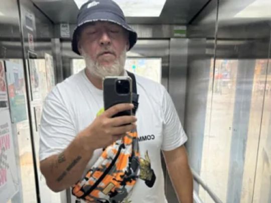 «Не береже молодість»: пластичний хірург оцінив зміни у зовнішності Потапа за останні роки (фото)