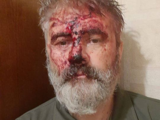 У Києві жорстоко побили митрополита ПЦУ, який захищає Україну