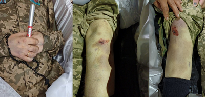 «На тілі синці, побої, губа розбита»: рідні не вірять у версію смерті бійця через хворобу й переконані, що його жорстоко побили