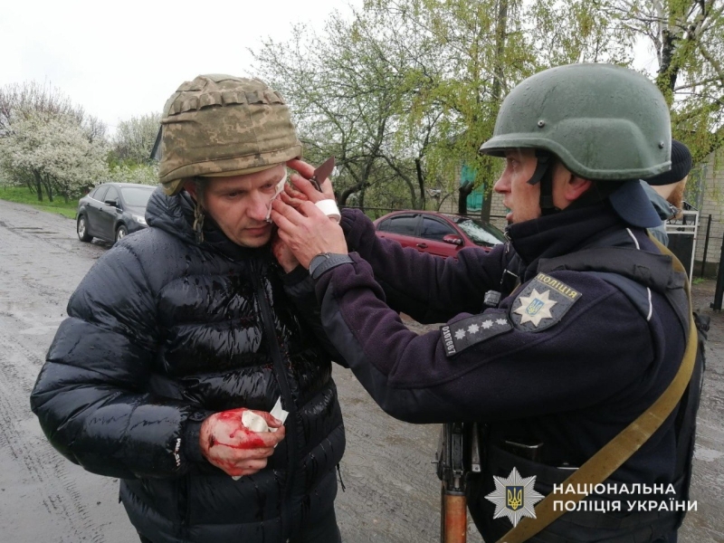 У&nbsp;поліцейських полетіли гранати: на&nbsp;Дніпропетровщині поранено п&rsquo;ятьох правоохоронців (фото)